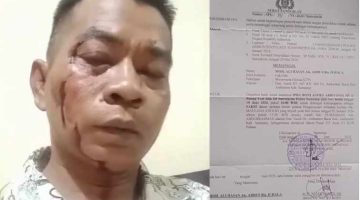 Penegakan Hukum di Polres Sumenep Diduga Tak Beres, Pelapor Korban Penganiayaan Malah Berbalik Jadi Terlapor