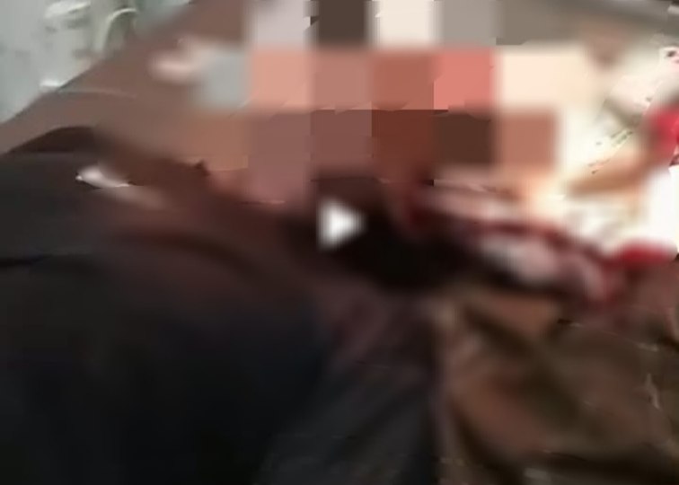 Geger, Warga Lesong Daya Pamekasan Tertusuk Moncong Ikan Marlin 